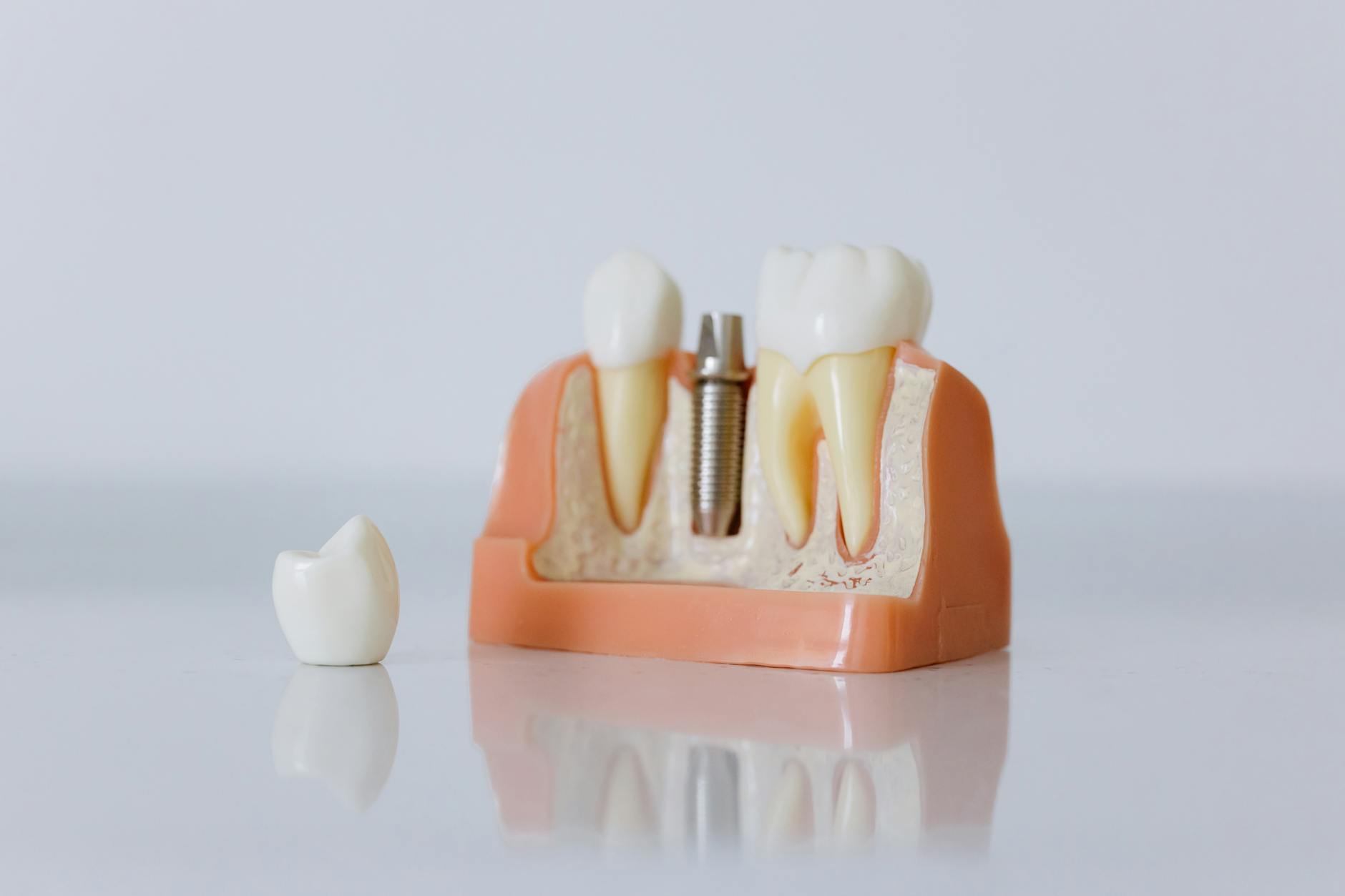 DePuy Hip Implant Lawsuit Settlement - Featured image