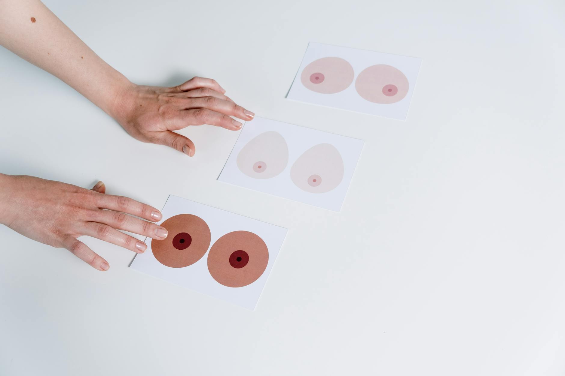 Inside the MDL — How the Allergan Breast Implant Litigation Works