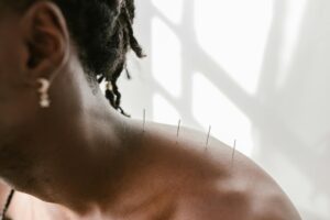 Acupuncture Malpractice Lawsuit - Featured image