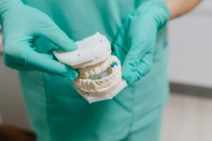 Dental Bridge Lawsuit - Featured image