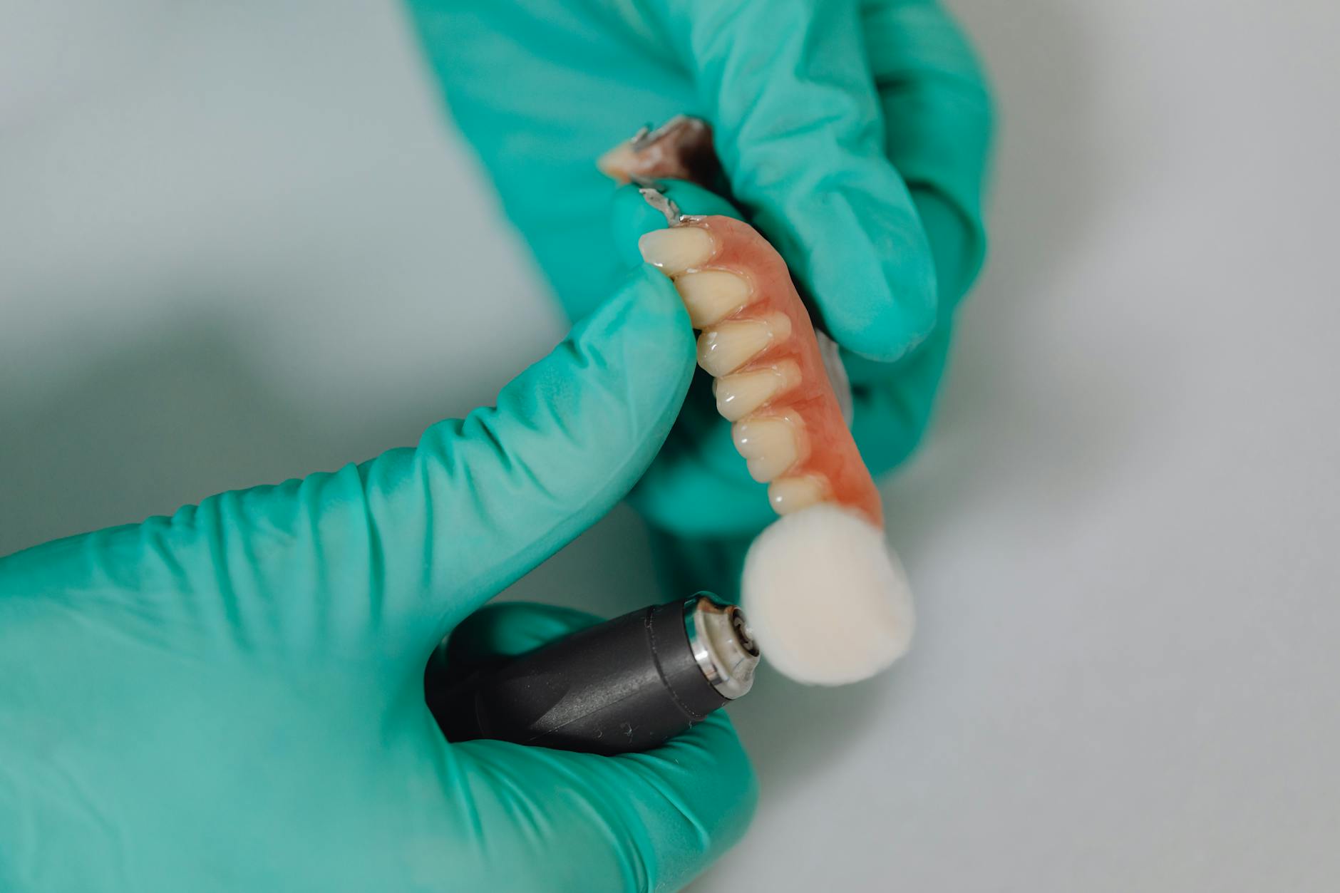 Dental Implant Failure Lawsuit - Featured image