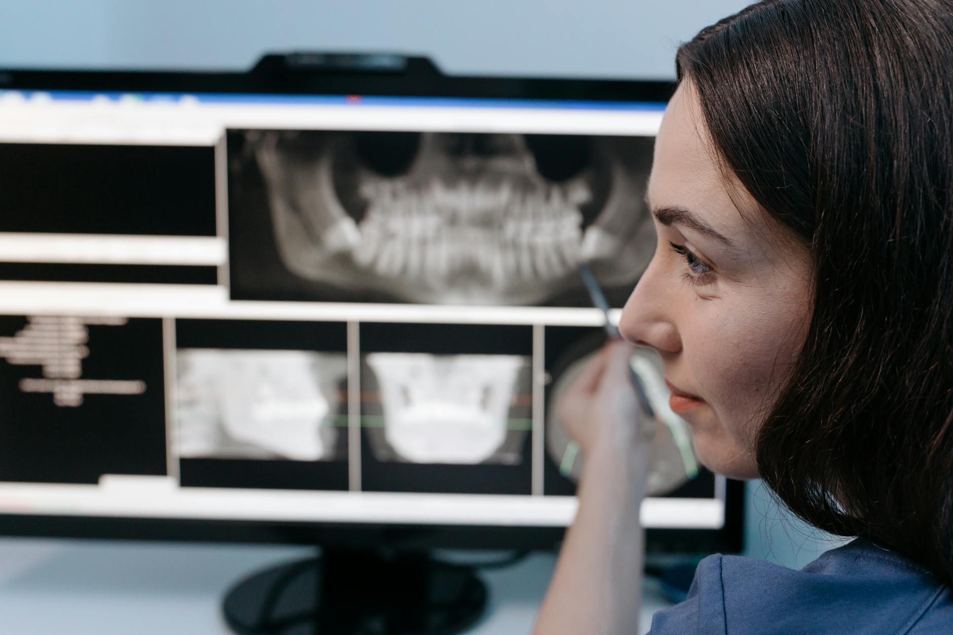 Dental X Ray Overexposure Lawsuit - Featured image