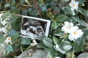 Ectopic Pregnancy Misdiagnosis Lawsuit - Featured image