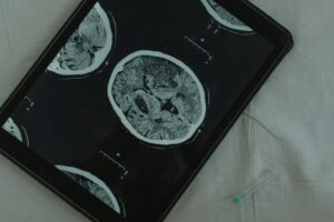 Electronic Health Record Lawsuit - Featured image