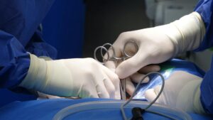Facelift Nerve Damage Lawsuit - Featured image