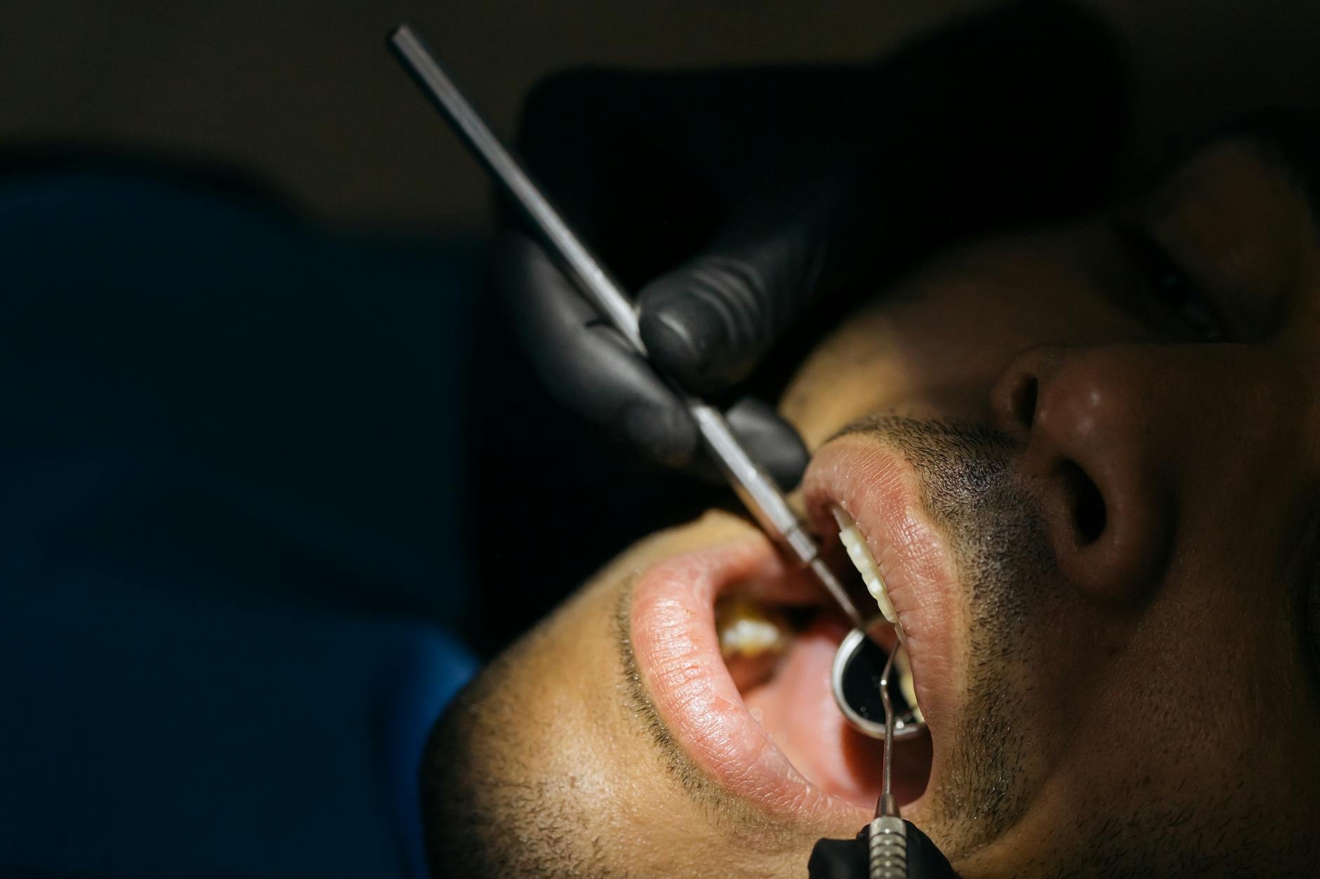 Geographic Variations in Dental Malpractice Rates