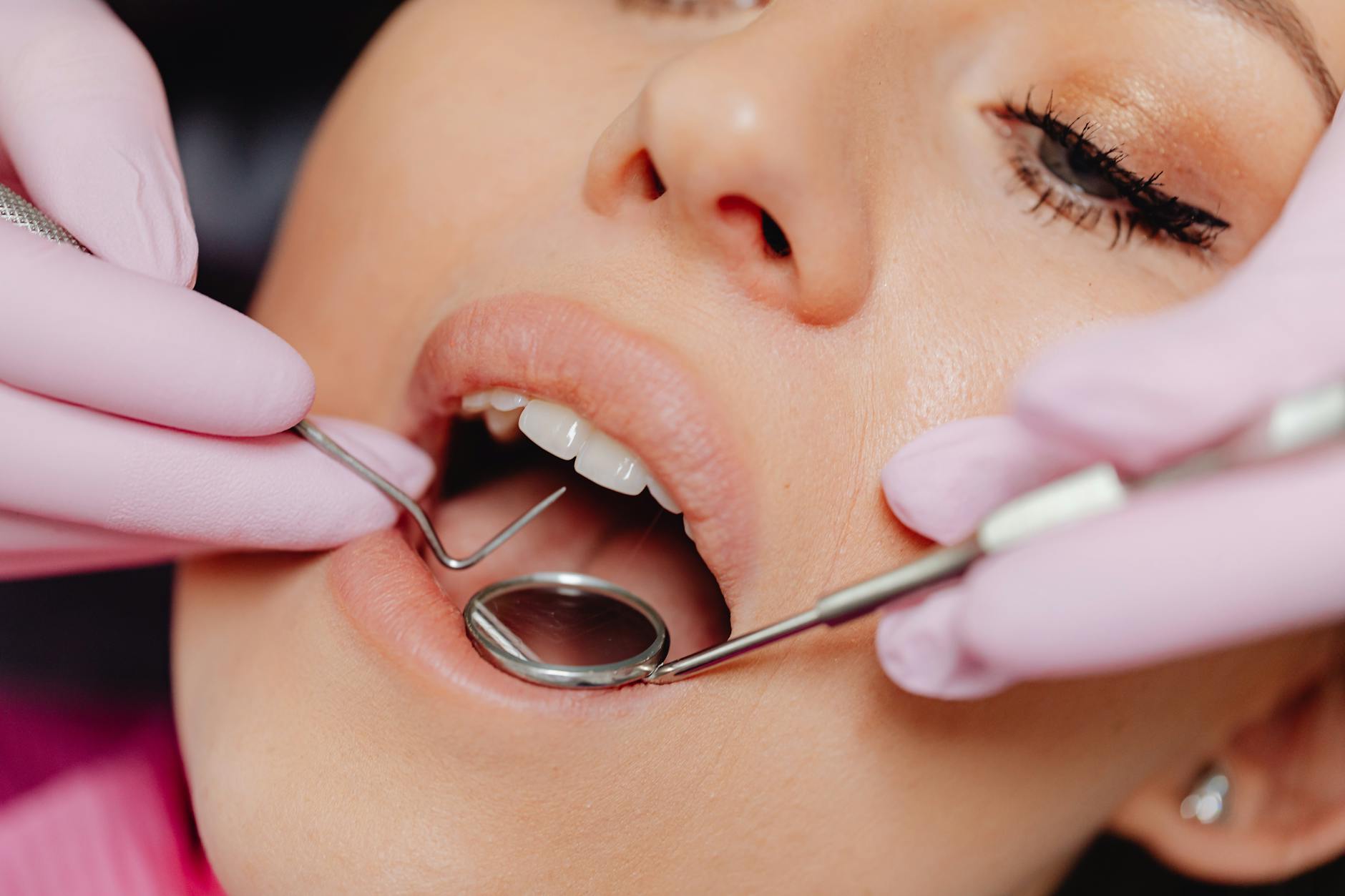How Often Do Dental Implants Fail?