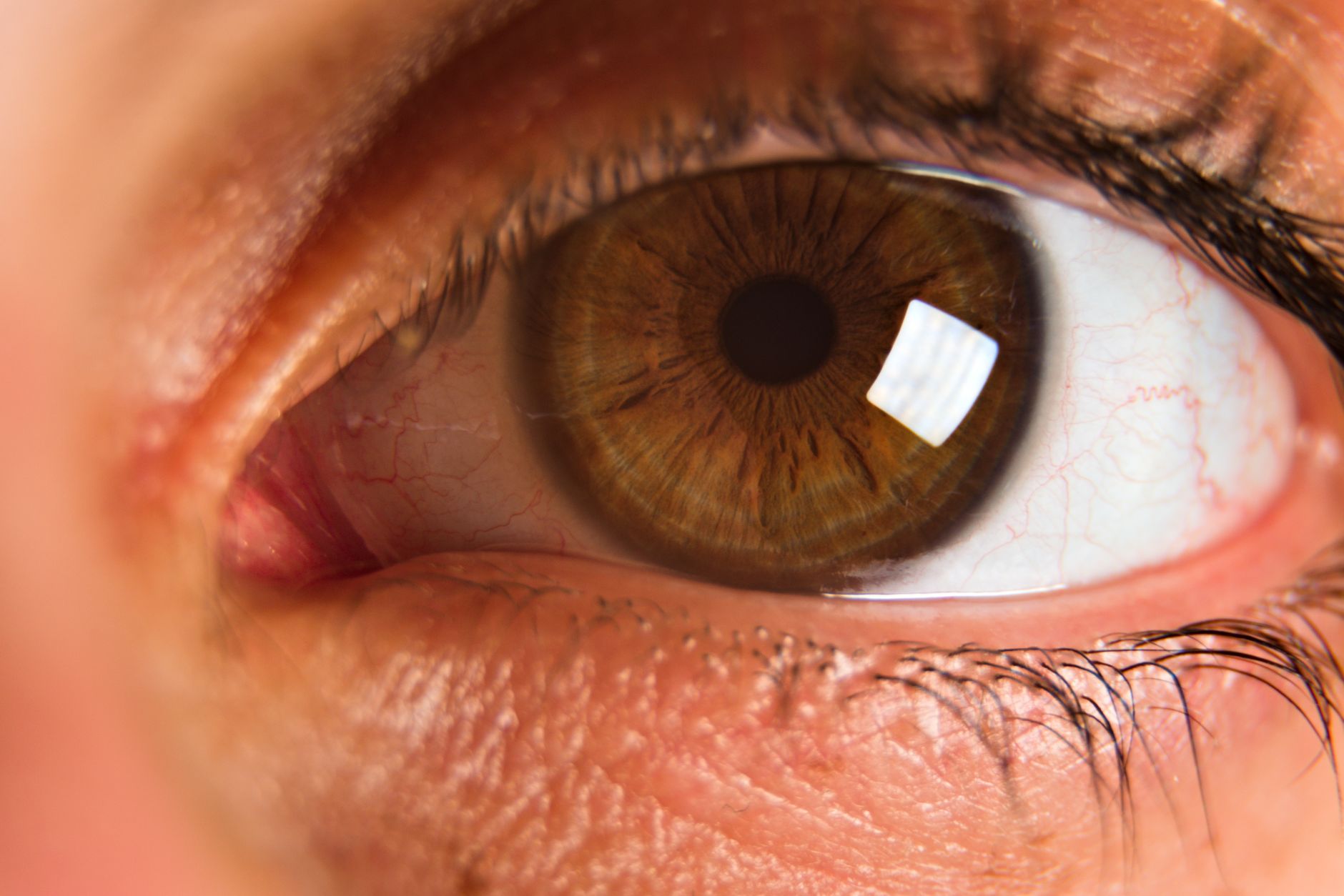 Intravitreal Injection Complications and Why Physicians Face Lawsuits
