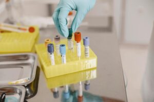 Laboratory Error Lawsuit - Featured image