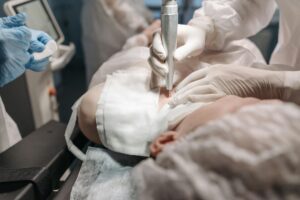 Plastic Surgery Malpractice Lawsuit - Featured image