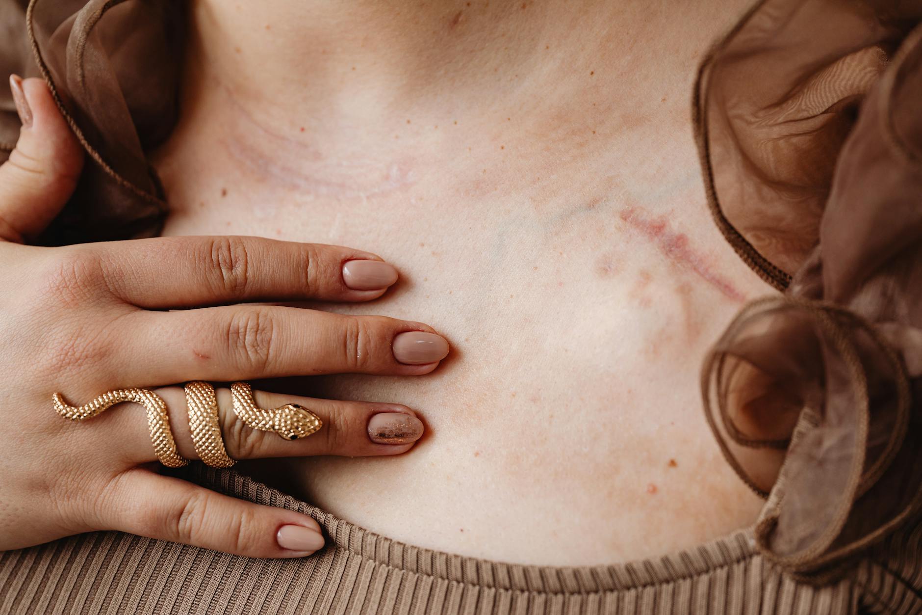 Postoperative Management Failures and Preventable Complications