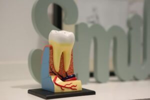 Root Canal Malpractice Lawsuit - Featured image