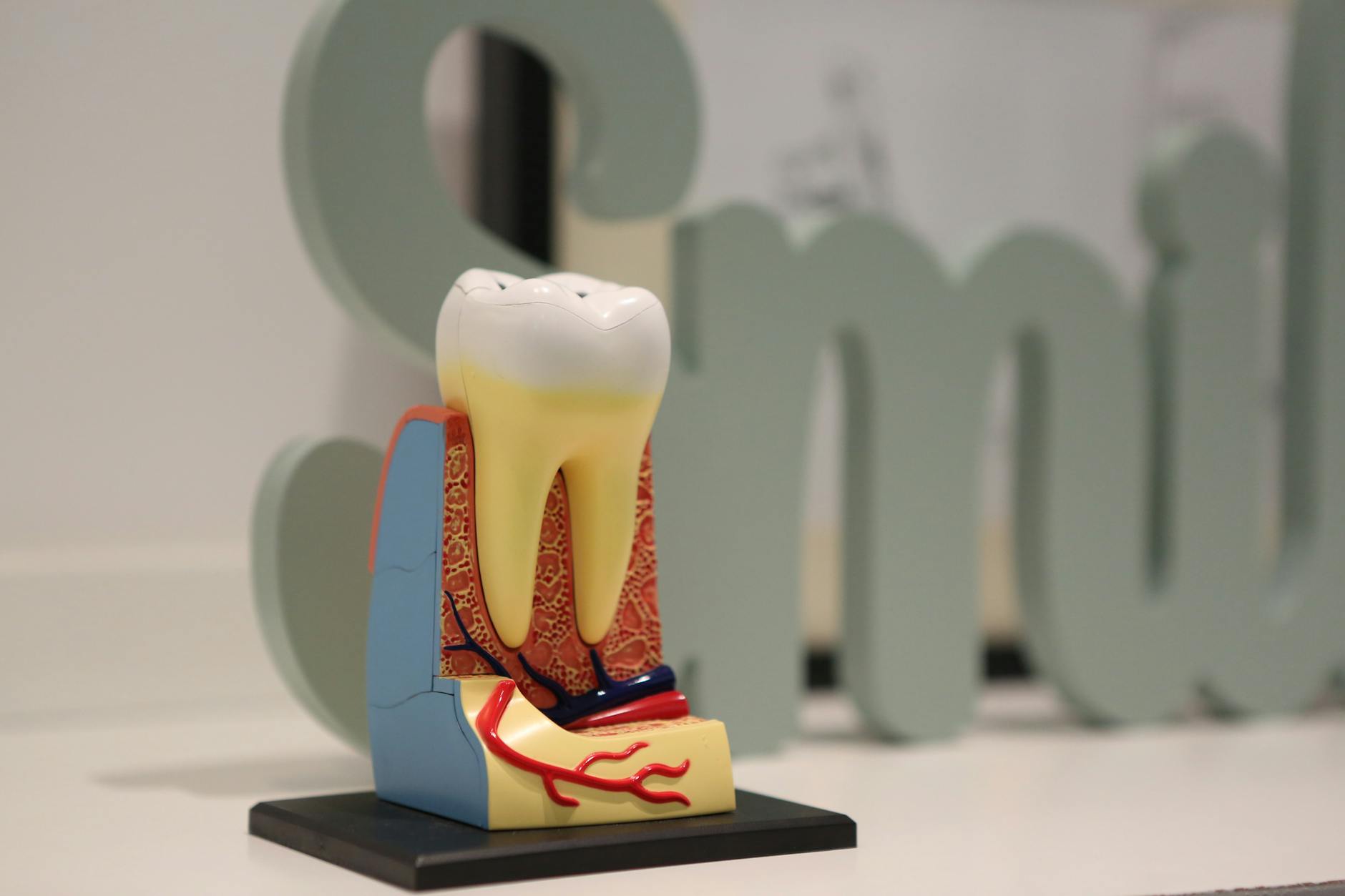 Root Canal Malpractice Lawsuit - Featured image