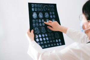 Stroke Misdiagnosis Lawsuit - Featured image