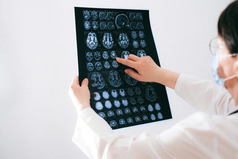 Stroke Misdiagnosis Lawsuit - Featured image
