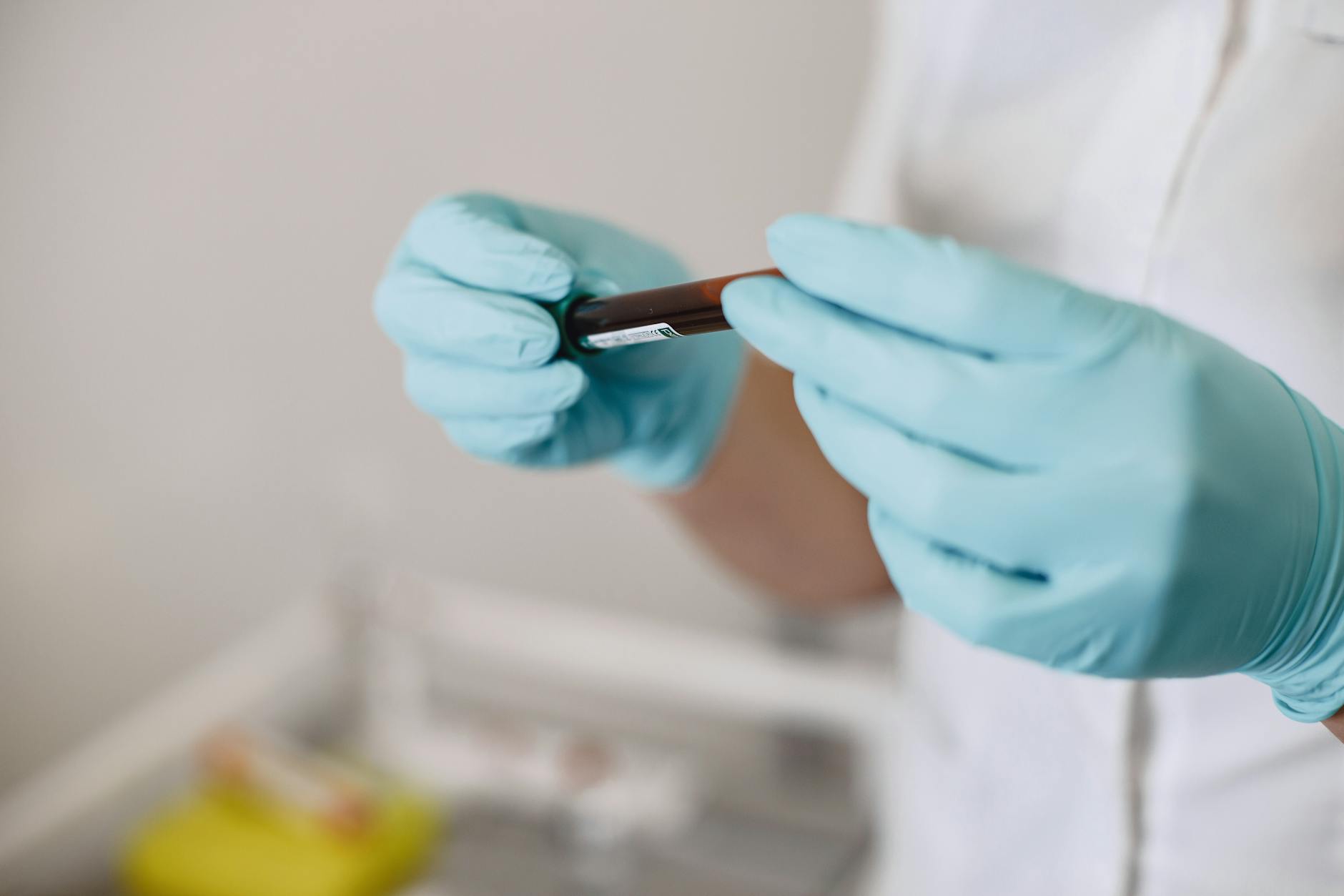 The Role of Pathology Labs and Specimen Handling