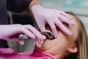 Tooth Extraction Nerve Damage Lawsuit - Featured image