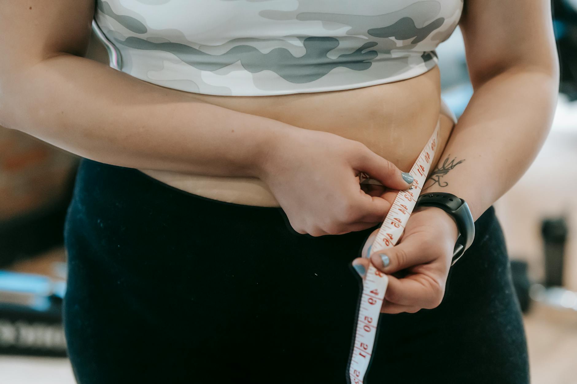 Tummy Tuck Complication Lawsuit - Featured image