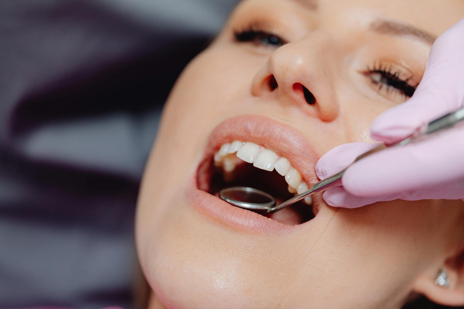 What Are Dental Bone Graft Lawsuits and Why Do They Occur?