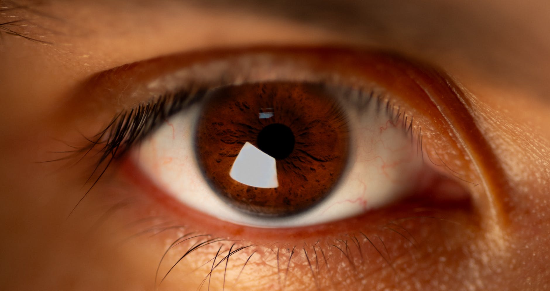 What Are Eye Injection Injuries and How Do They Lead to Lawsuits?