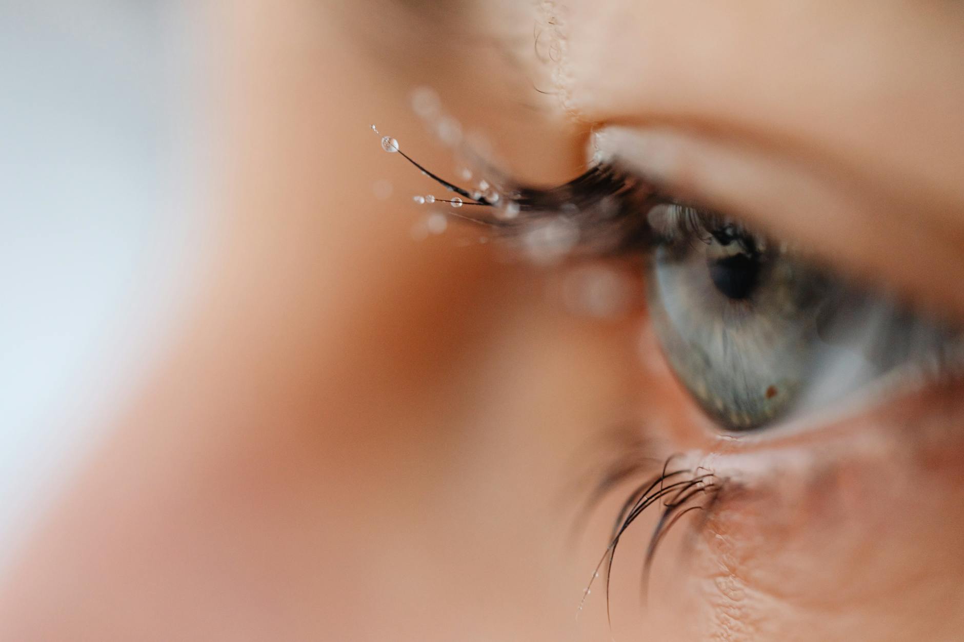 What Are Intraocular Lens Defects and Why Do They Matter?