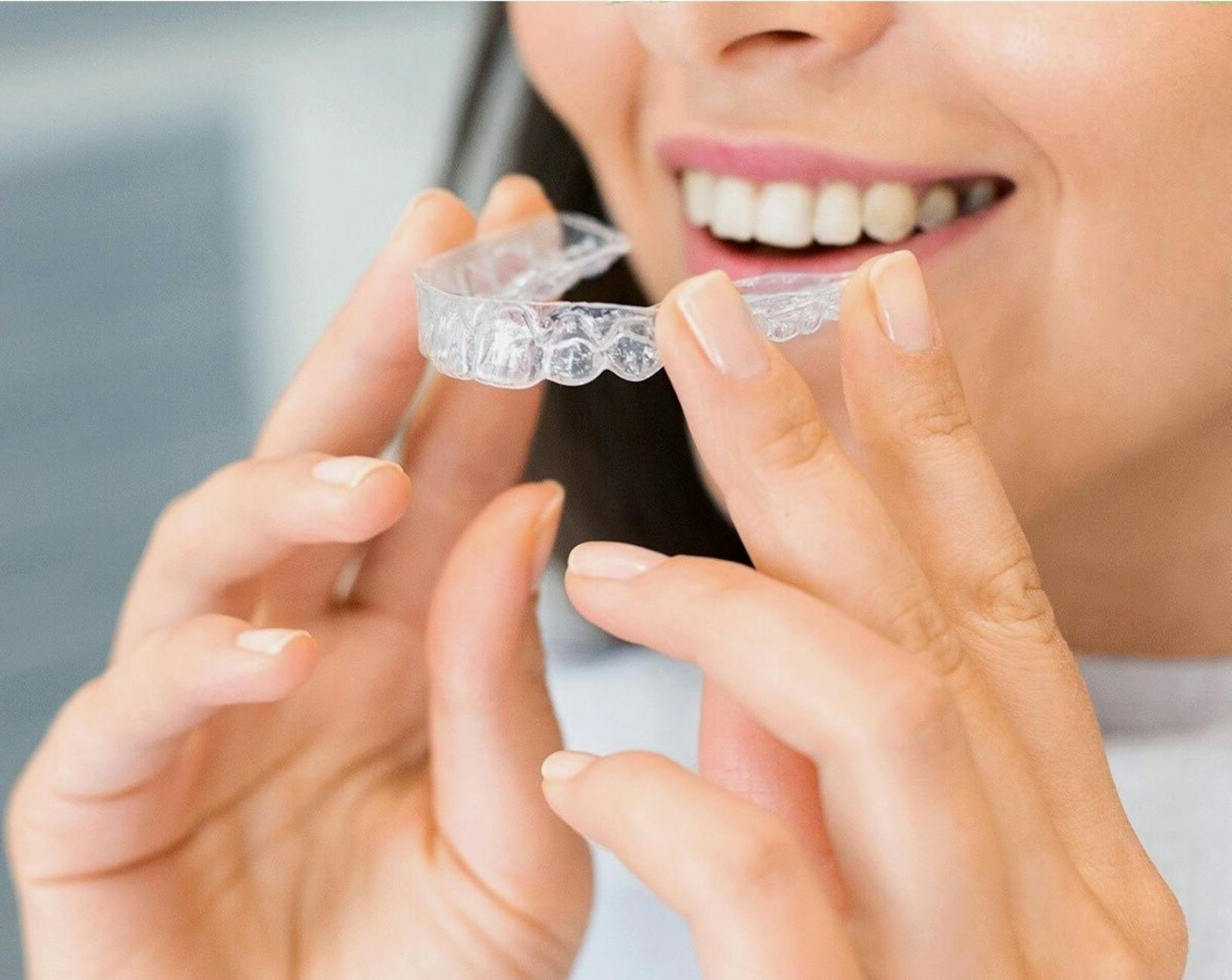 What Are the Invisalign Class Action Lawsuits?