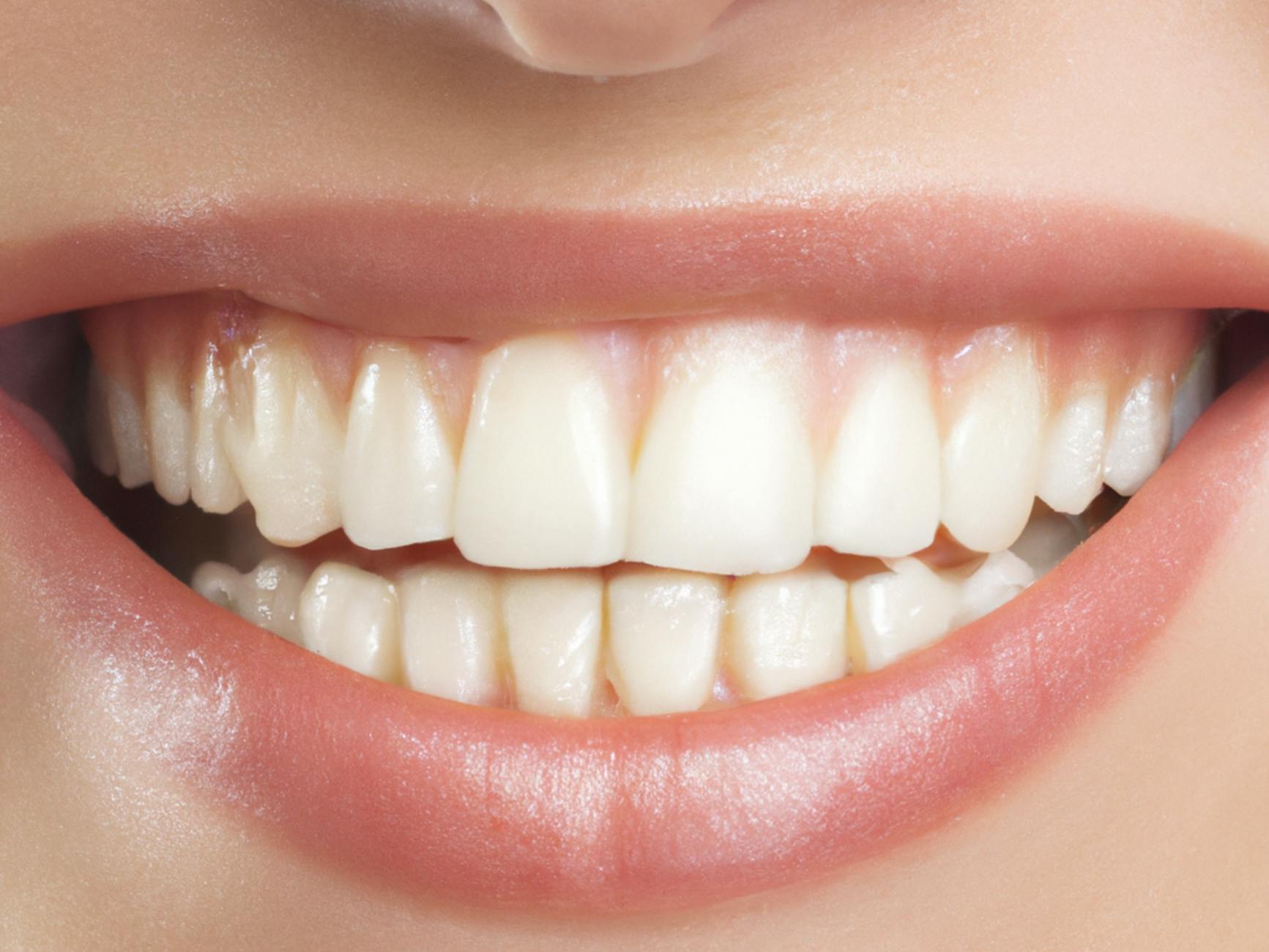 What Causes Dental Sedation Deaths?