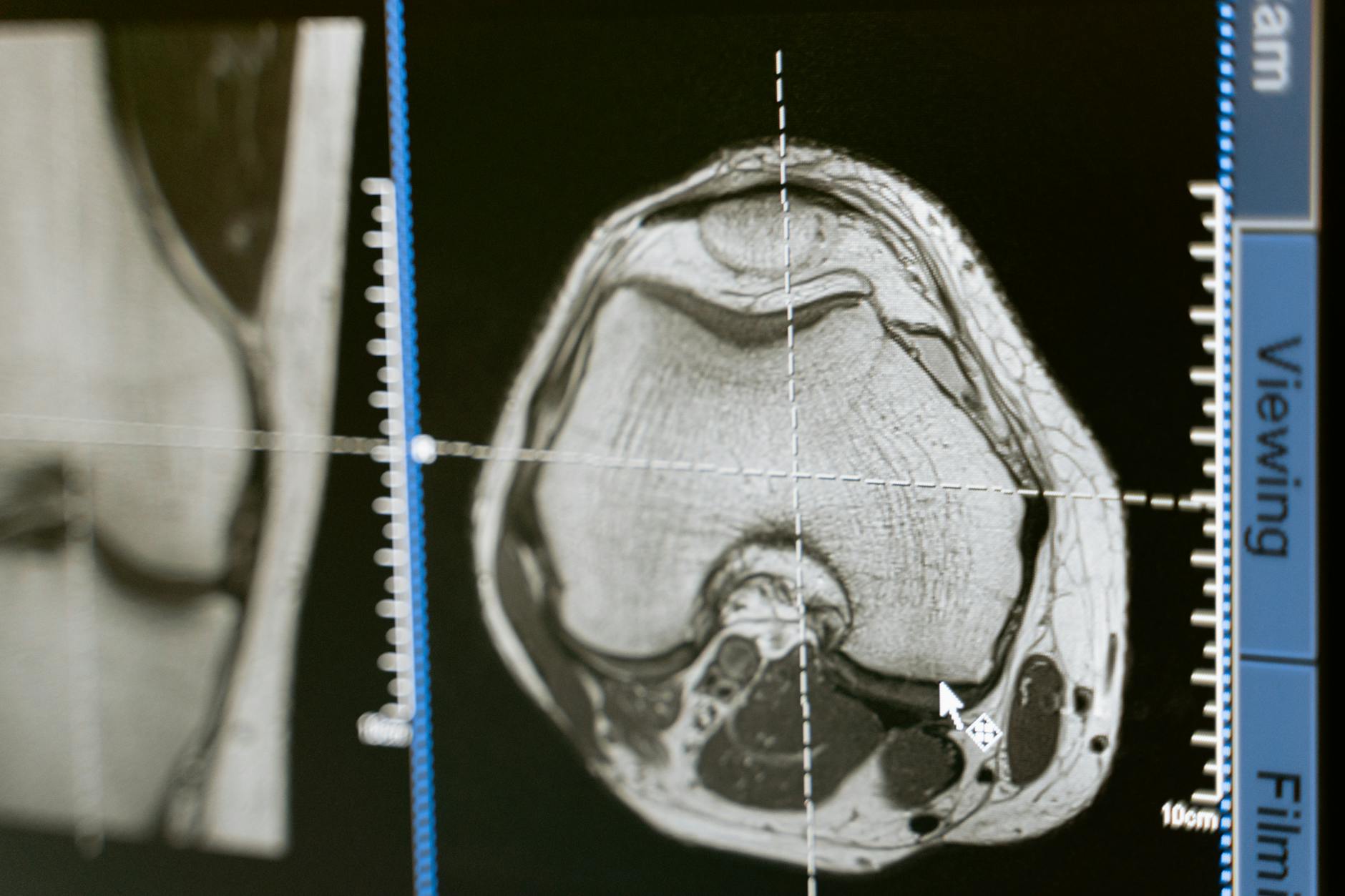 WHAT CAUSES RADIOLOGY MISREADS AND HOW OFTEN DO THEY OCCUR?