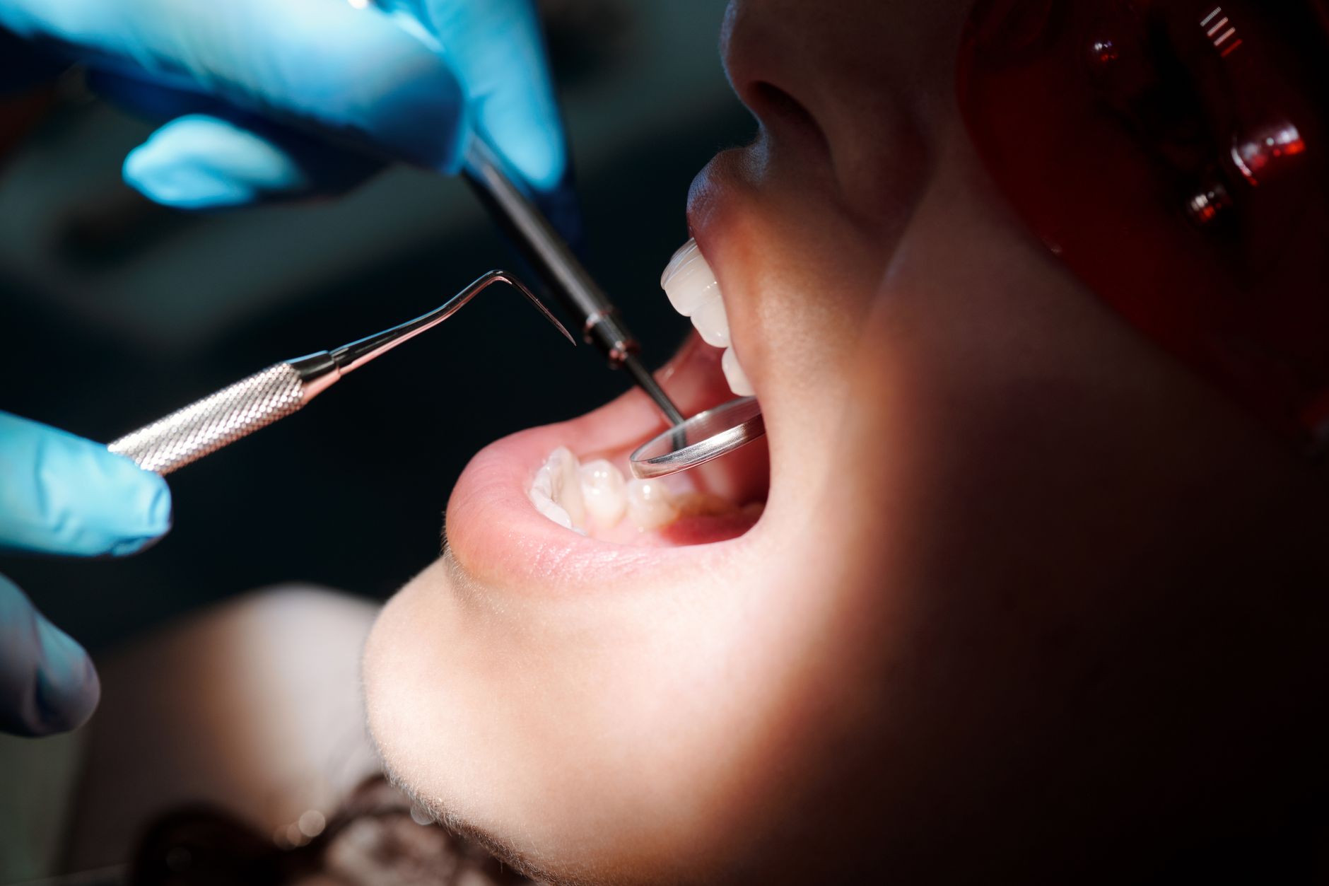 WHAT CONSTITUTES DENTAL X-RAY OVEREXPOSURE AND WHEN IT'S ACTIONABLE