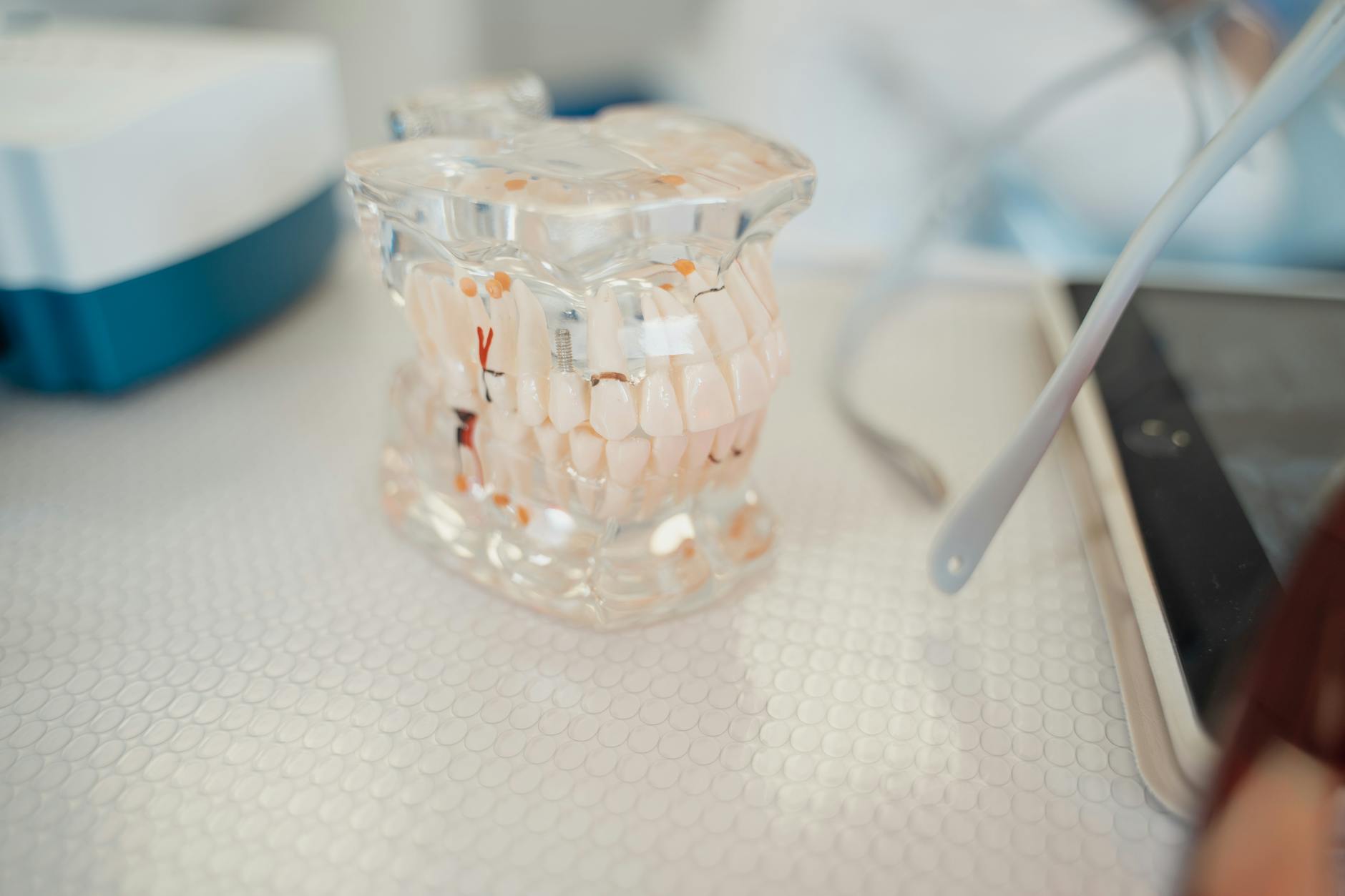 What Constitutes Denture Malpractice and Common Claims?