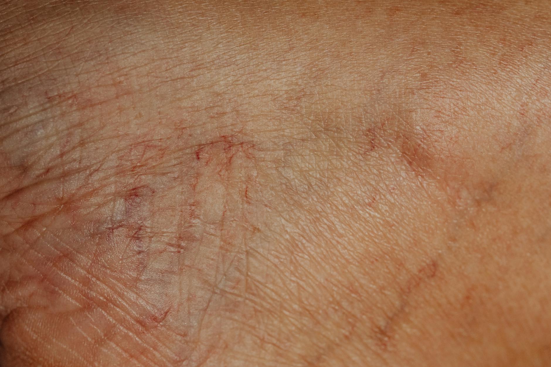 WHAT TYPES OF COMPLICATIONS TRIGGER OUTPATIENT SURGERY LAWSUITS?