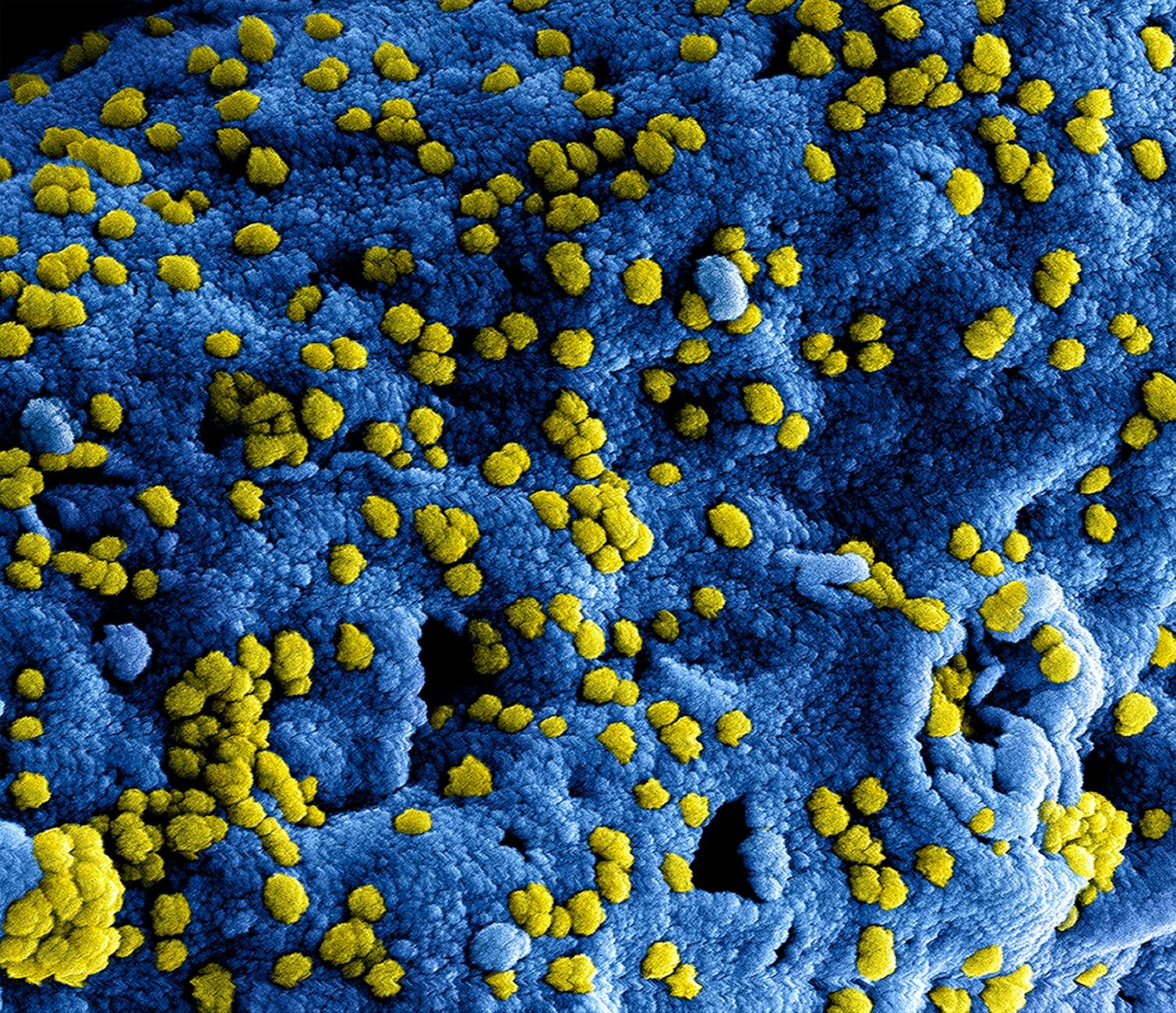 What Types of Infections Drive Nursing Home Lawsuits?