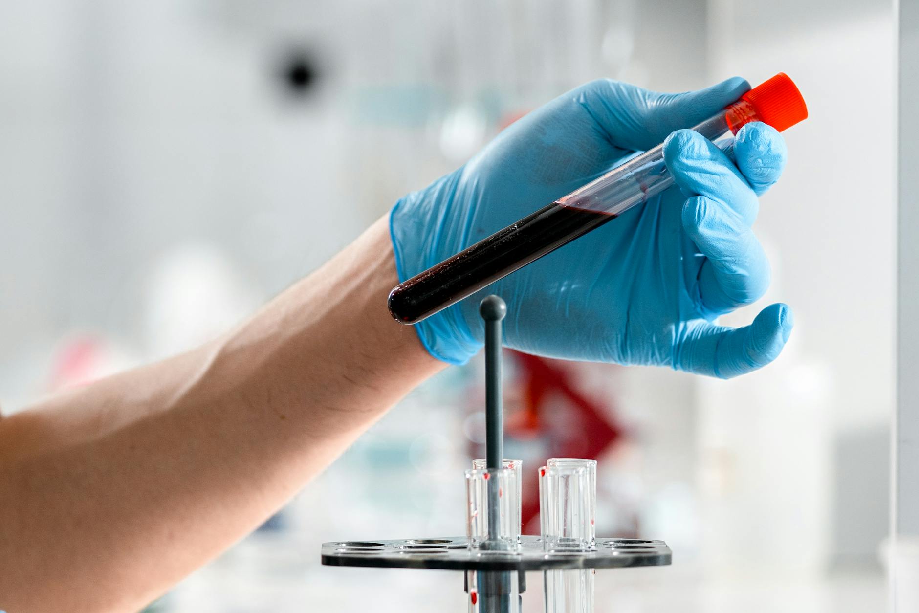 What Types of Laboratory Errors Lead to Lawsuits?
