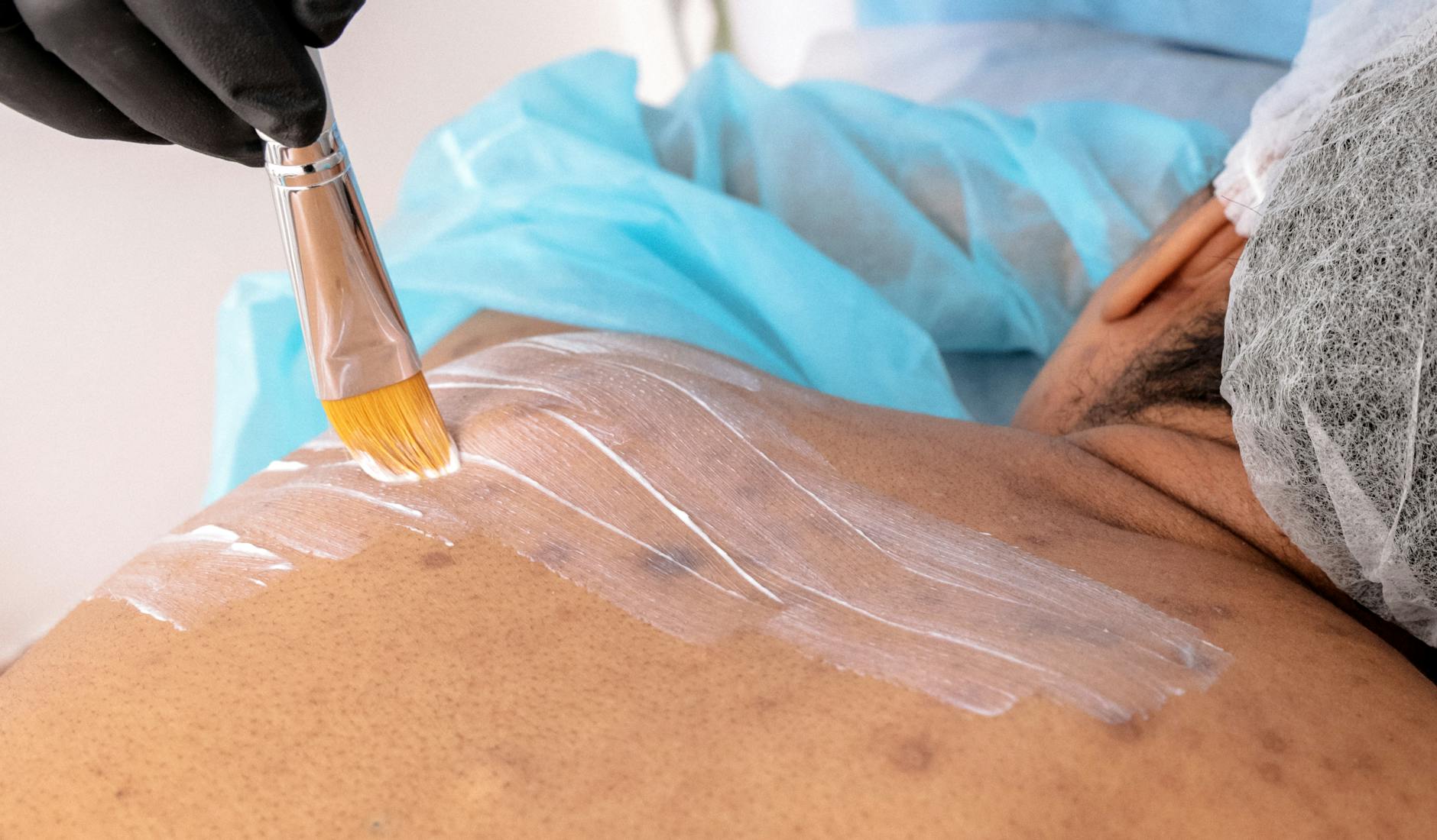 What Types of Treatment Are Being Denied?