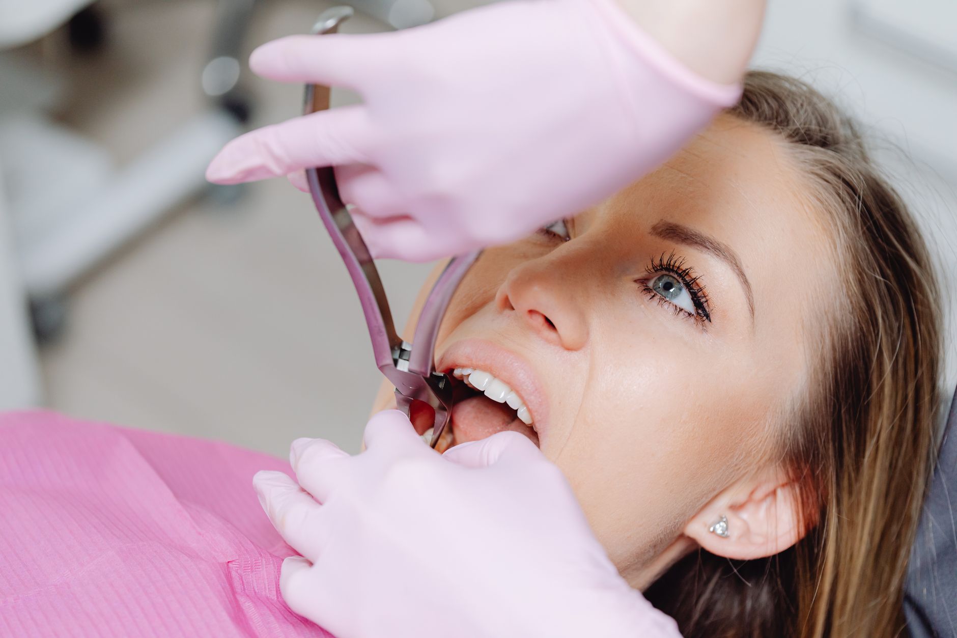 Wisdom Teeth Extraction Lawsuit - Featured image