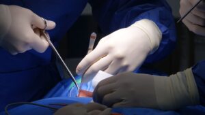 Covidien Hernia Mesh Lawsuit Trial Starts: Symbotex Defect Claims In Court - Featured image